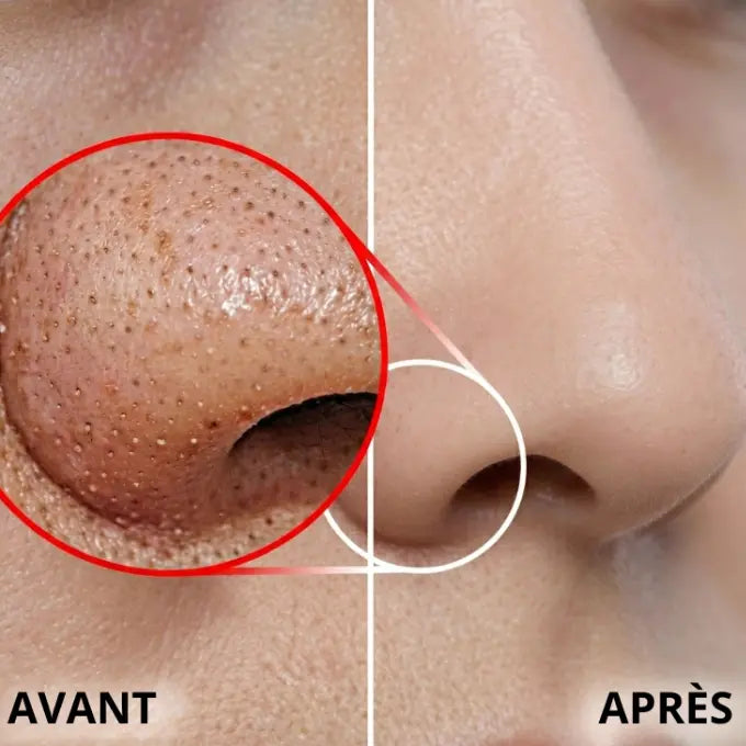 Sérum Exfoliant au Riz Blanc DAYIR