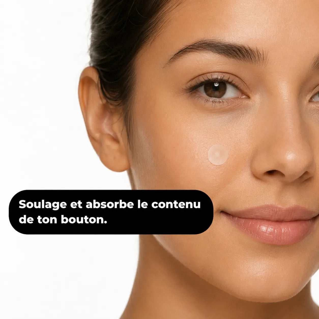 Patchs anti-acné